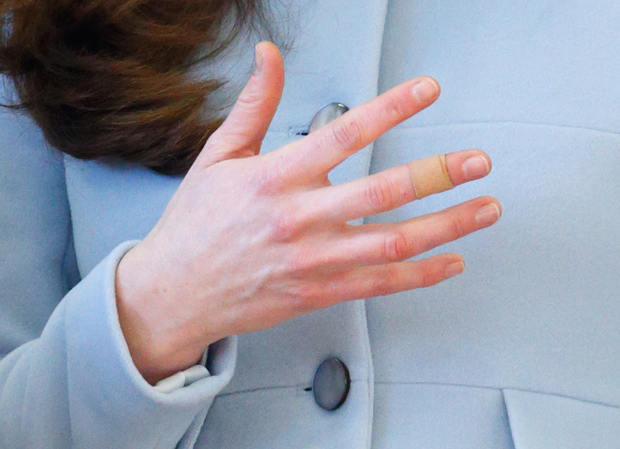 Gros plan sur le doigt bandé de la princesse Catherine lors de sa visite à la Kensington Aldridge Academy à Londres, en Angleterre, le 19 janvier 2015 | Source : Getty Images