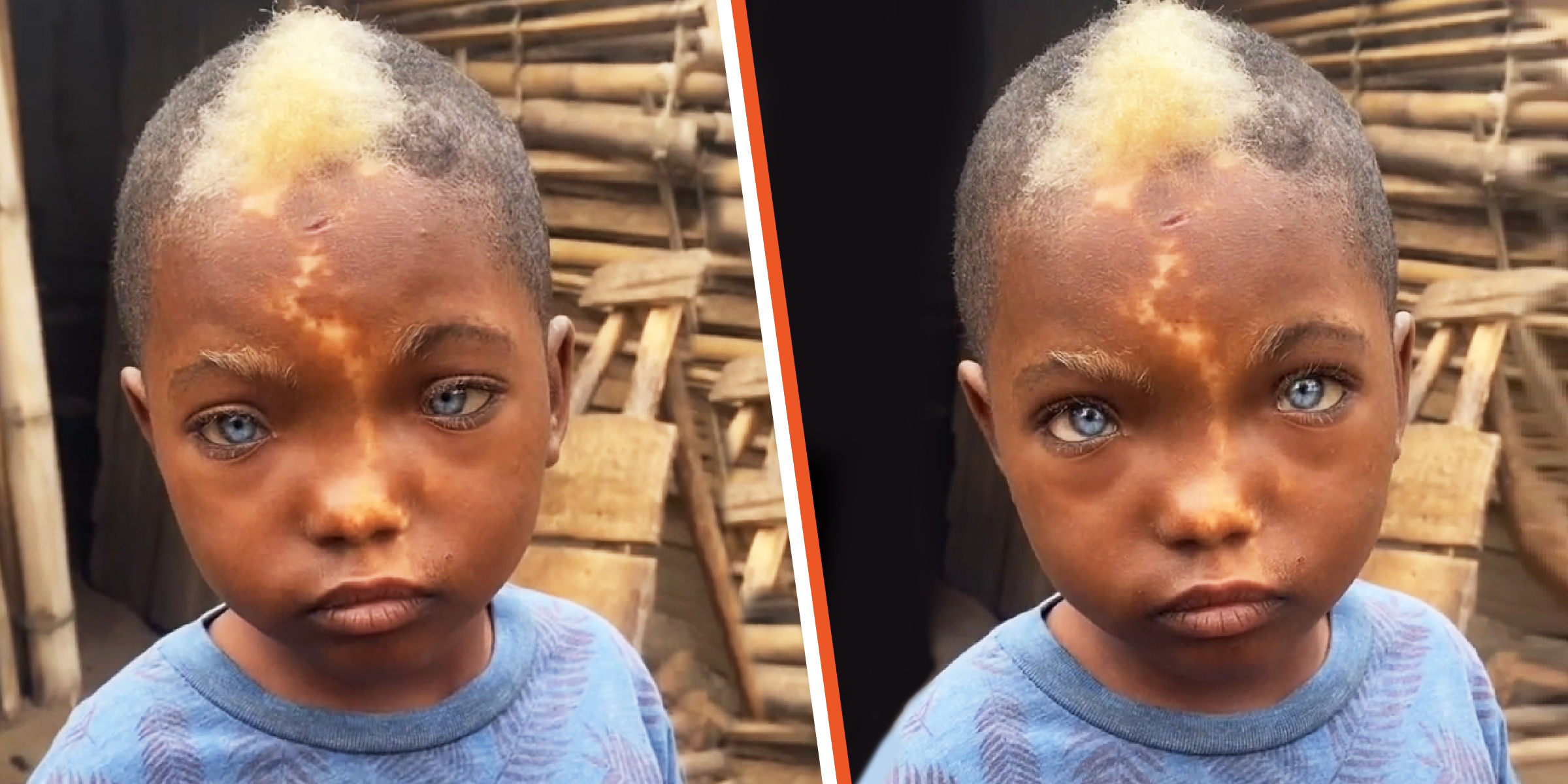 Un petit garçon noir avec une mèche de cheveux blancs, une tache de naissance en forme d'éclair et des yeux bleus | Source : tiktok.com/raoultsasa0