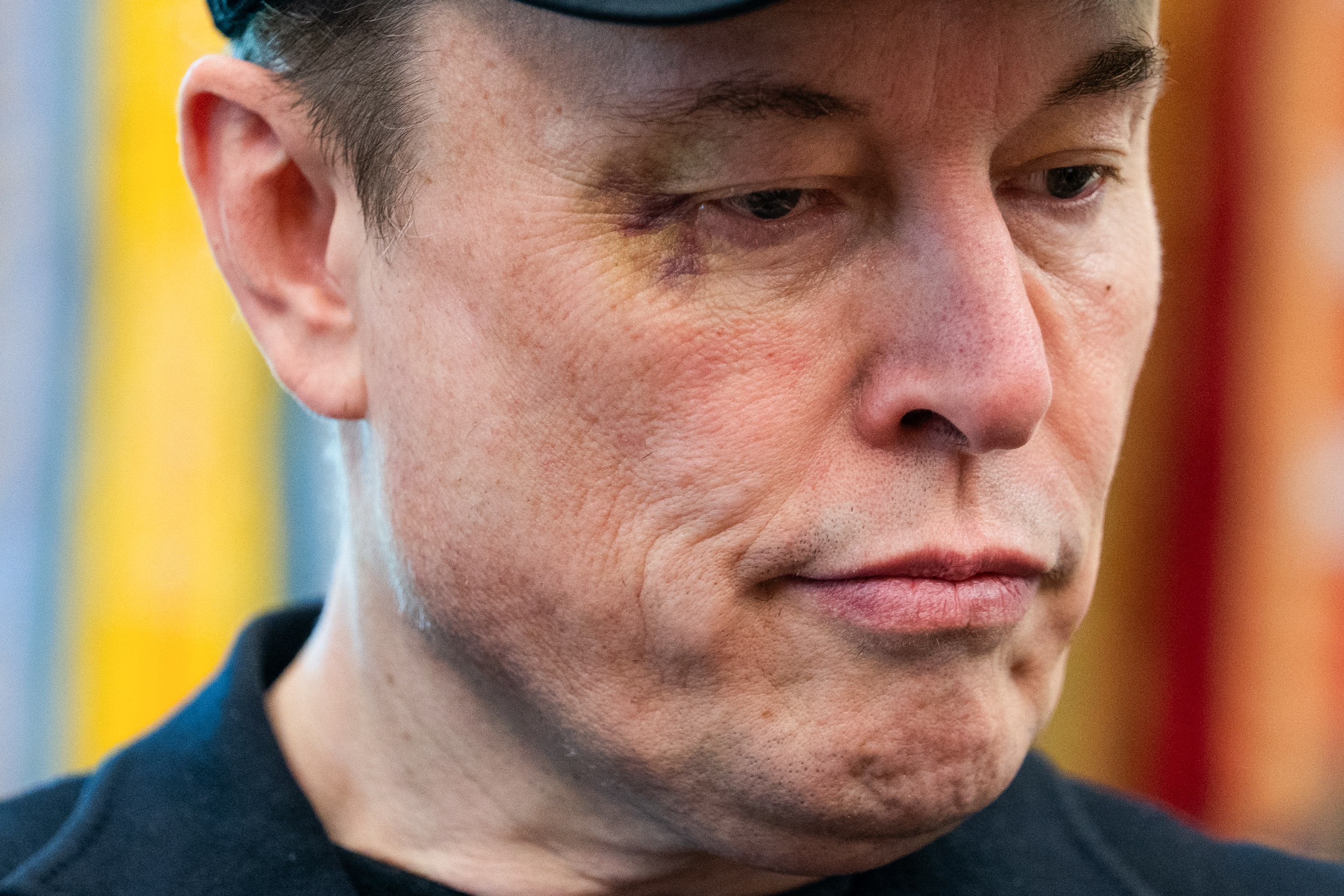 Lorsqu'on l'a interrogé sur sa blessure, Musk a expliqué avec désinvolture qu'elle était le résultat d'un jeu brutal avec son fils de cinq ans, X Æ A-12.