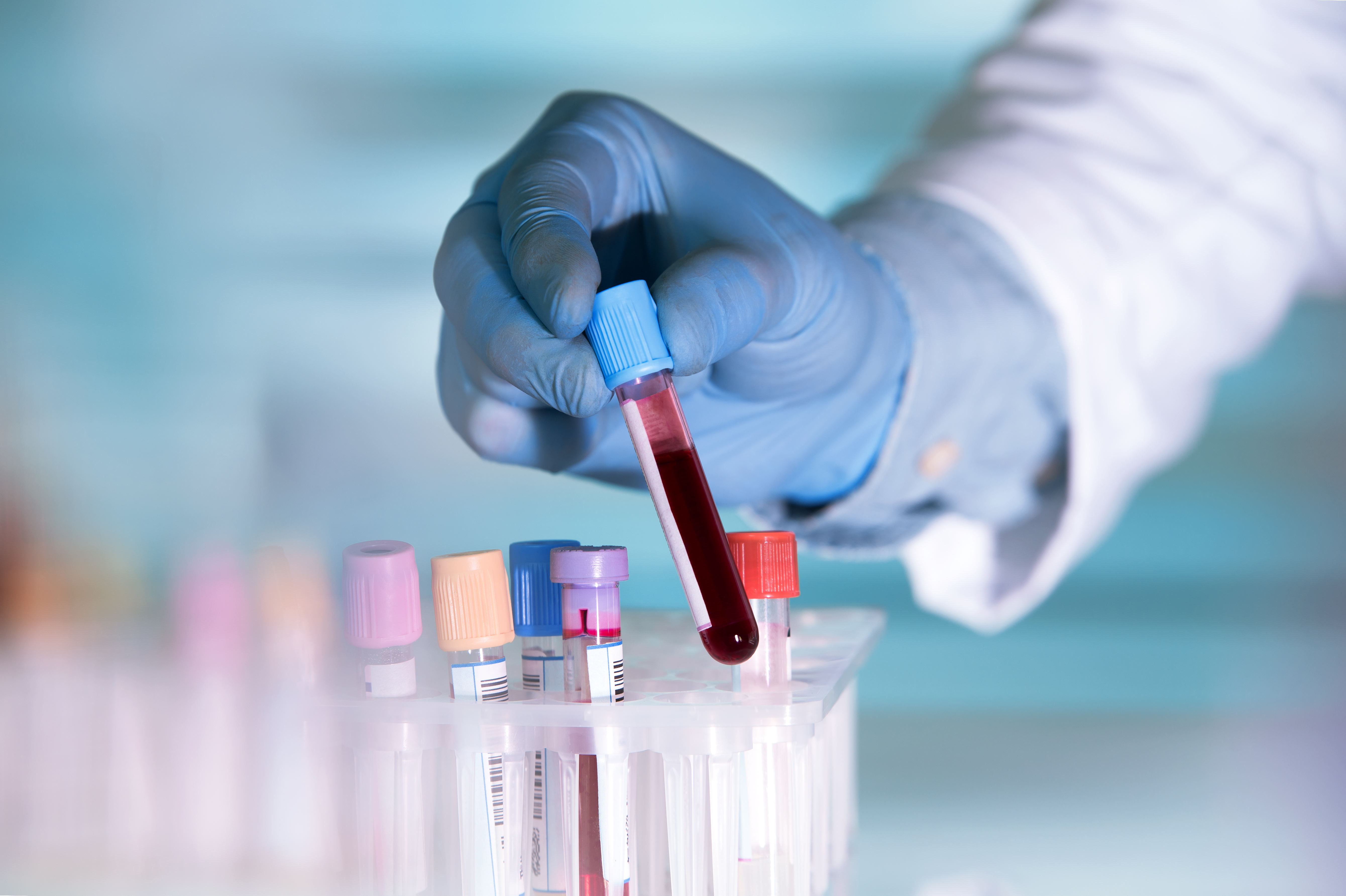 Sangue para testes | Fonte: Shutterstock