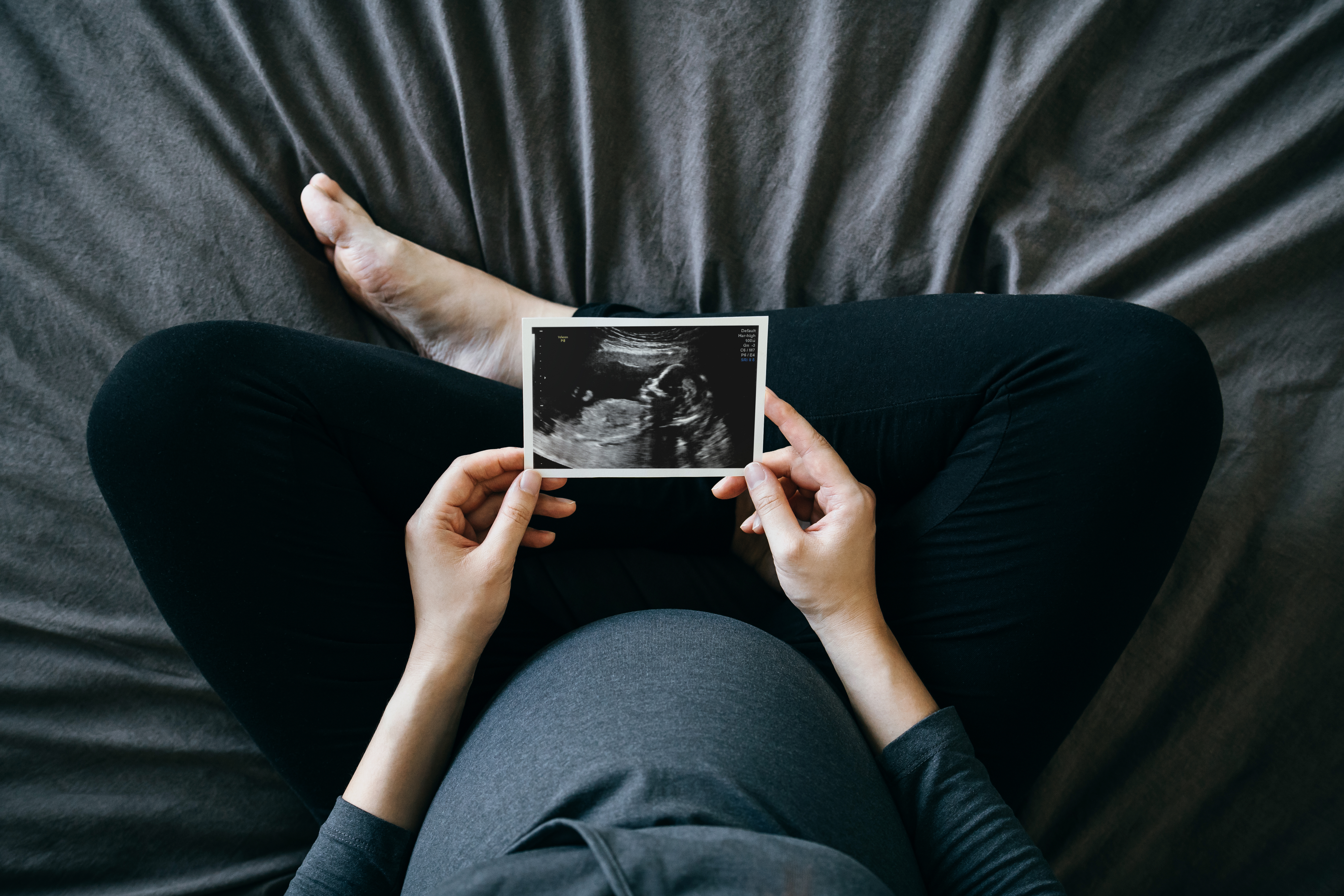 Une femme enceinte tenant une photo d'échographie | Source : Getty Images