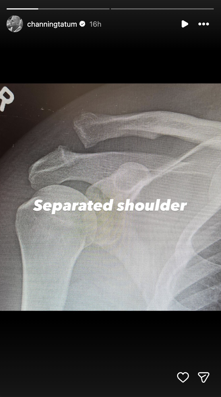 Channing Tatum documente sa blessure | Source : Instagram/channingtatum