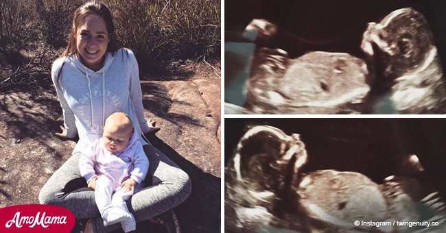 6 semaines après que cette mère ait donné naissance à une petite fille, les radios ont révélé qu'elle était enceinte de jumeaux
