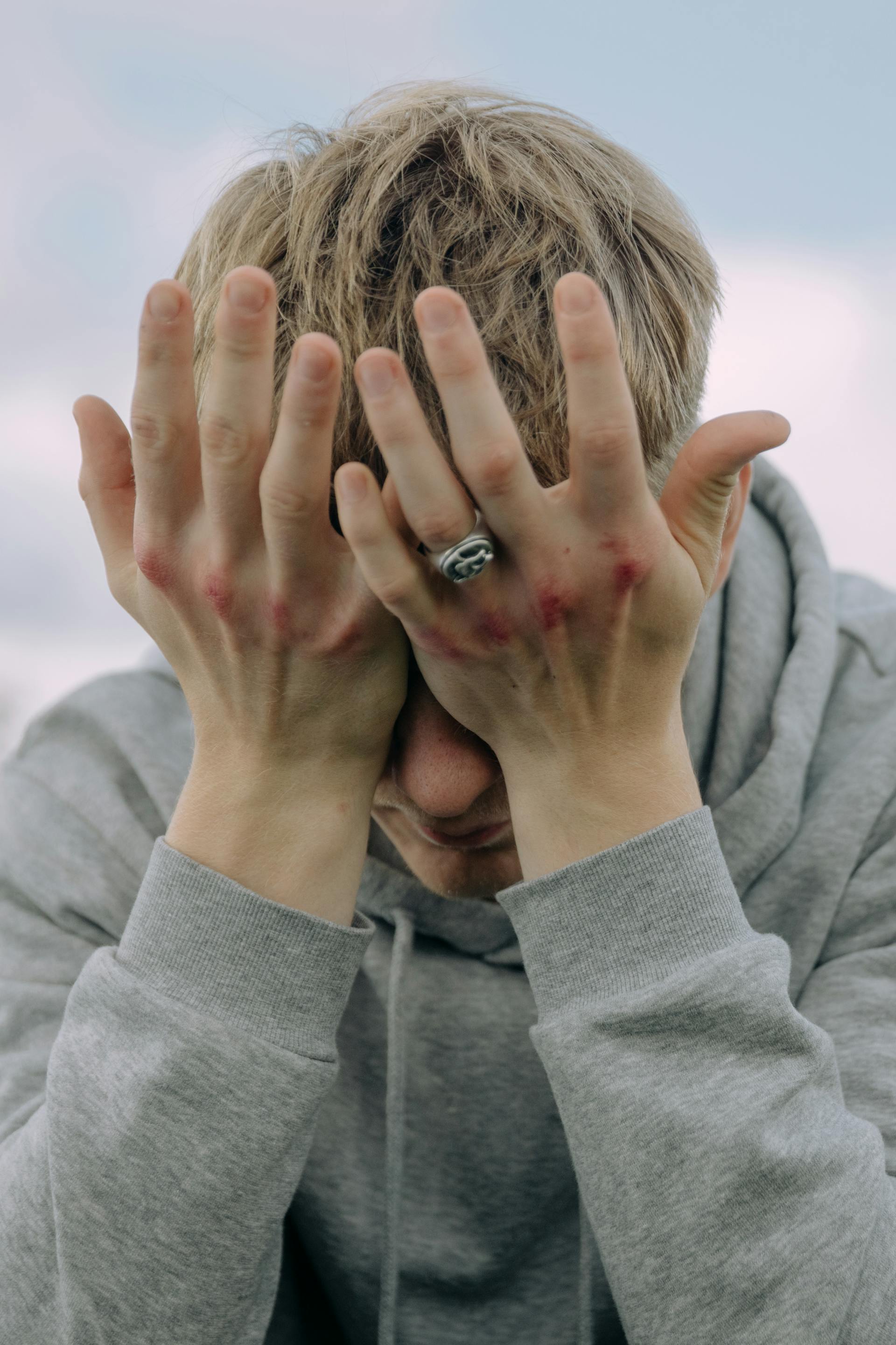 Un homme aux articulations meurtries se couvrant le visage avec ses mains | Source : Pexels