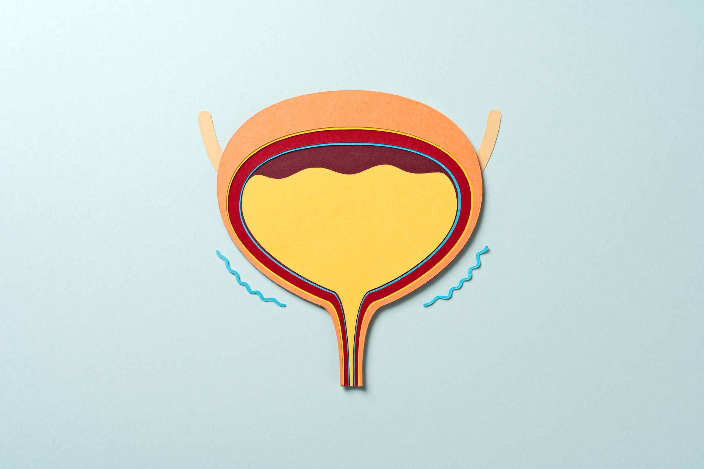 Modèle en papier d'une vessie humaine remplie d'urine | Source : Getty Images