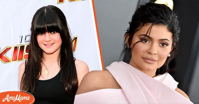 L'actrice de télé-réalité et entrepreneuse Kylie Jenner avant et après s'être fait refaire les lèvres. | Source : Getty Images