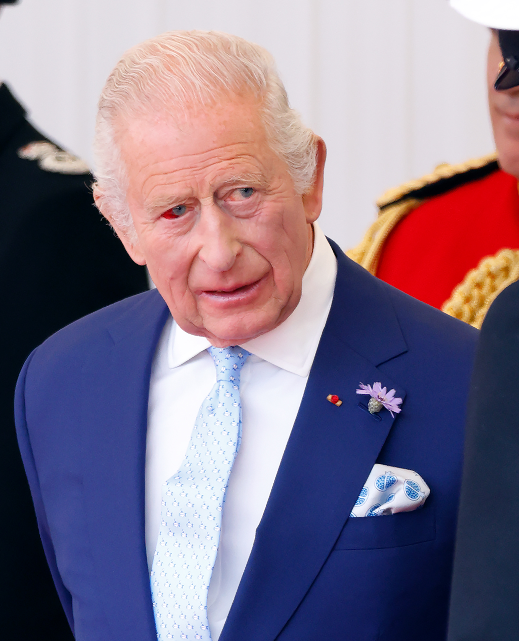 La rupture d'un vaisseau sanguin chez le roi Charles III est plus visible sur cette image saisissante prise lors de la cérémonie d'accueil des Macron. Le monarque, bien que visiblement affecté, conserve son attitude diplomatique en compagnie du personnel militaire.
