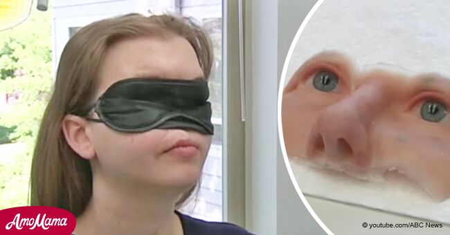 Une jeune fille sur qui on a tiré dans le visage retire son masque pour montrer le nouveau visage qu'elle a reçu