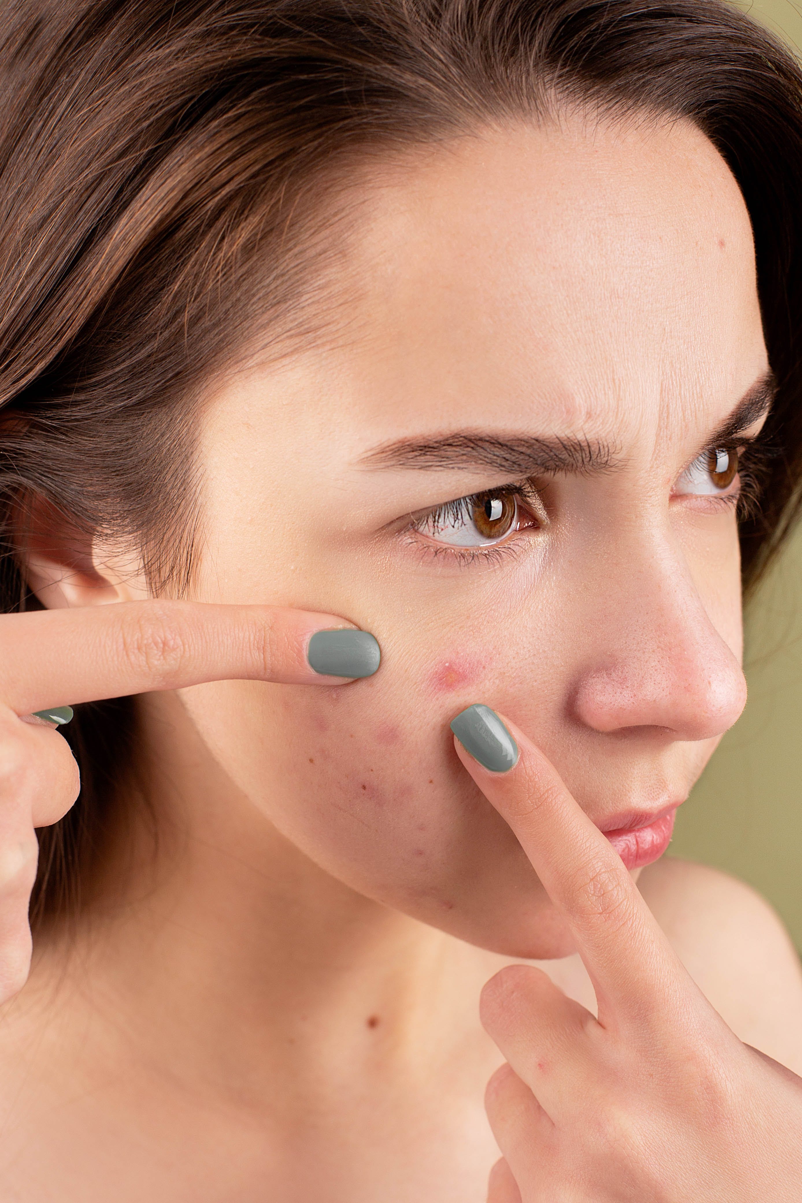 Une femme en train d'écraser un bouton sur son visage : Source : Pexels