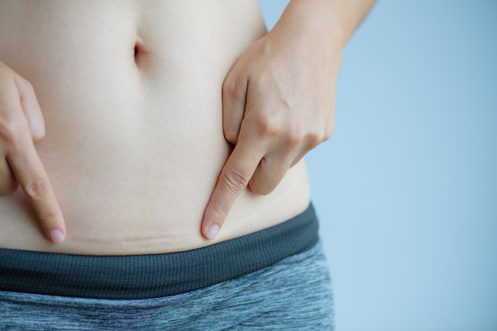 Abdomen féminin. C'est le premier symptôme. | Photo : Shutterstock
