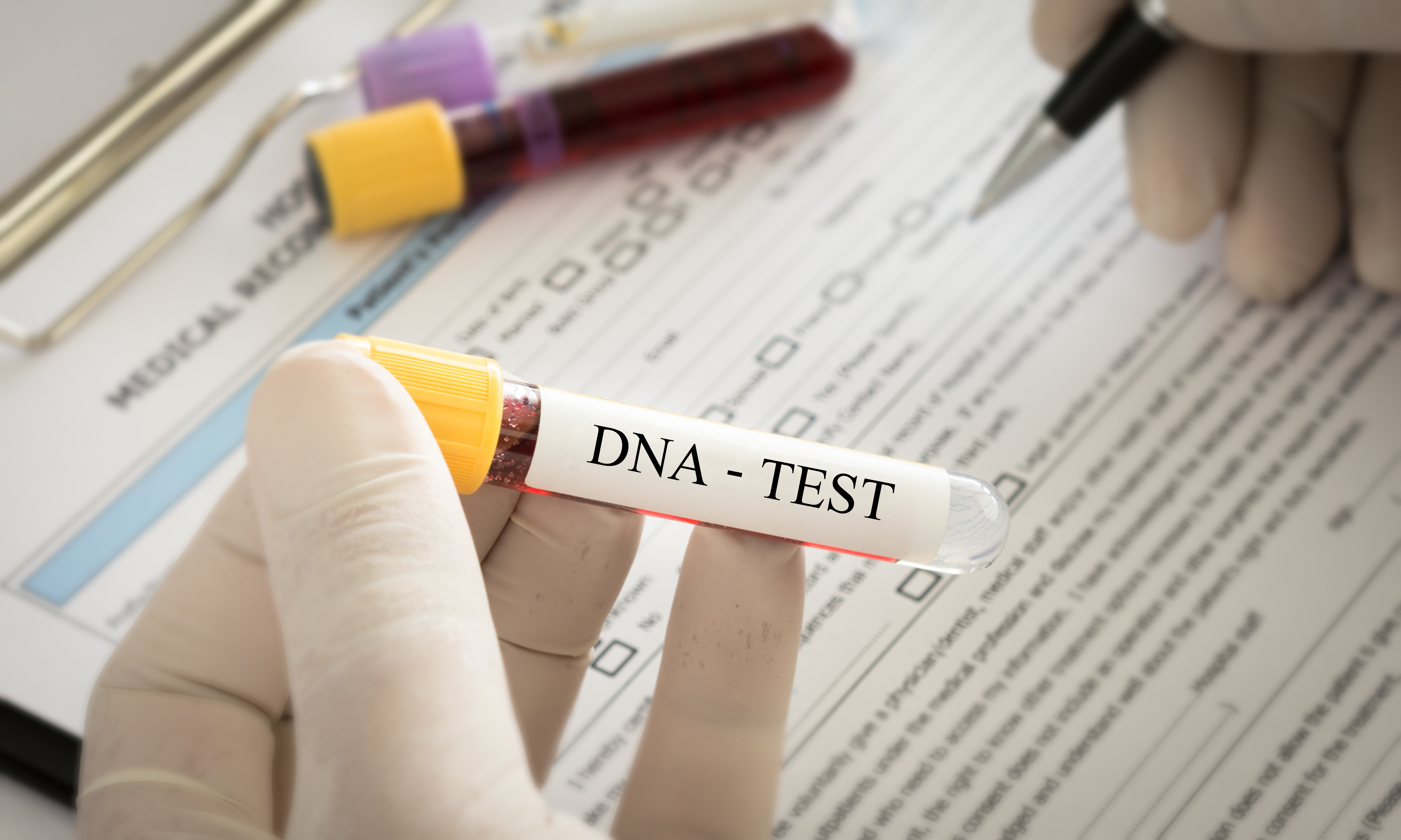 Un test ADN | Source : Getty Images