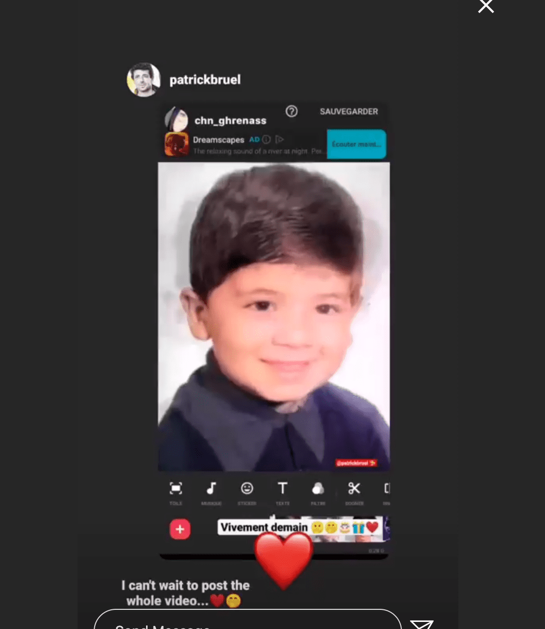 Photo de Patrick Bruel quand il était enfant. | Photo : Story Instagram / Patrick Bruel