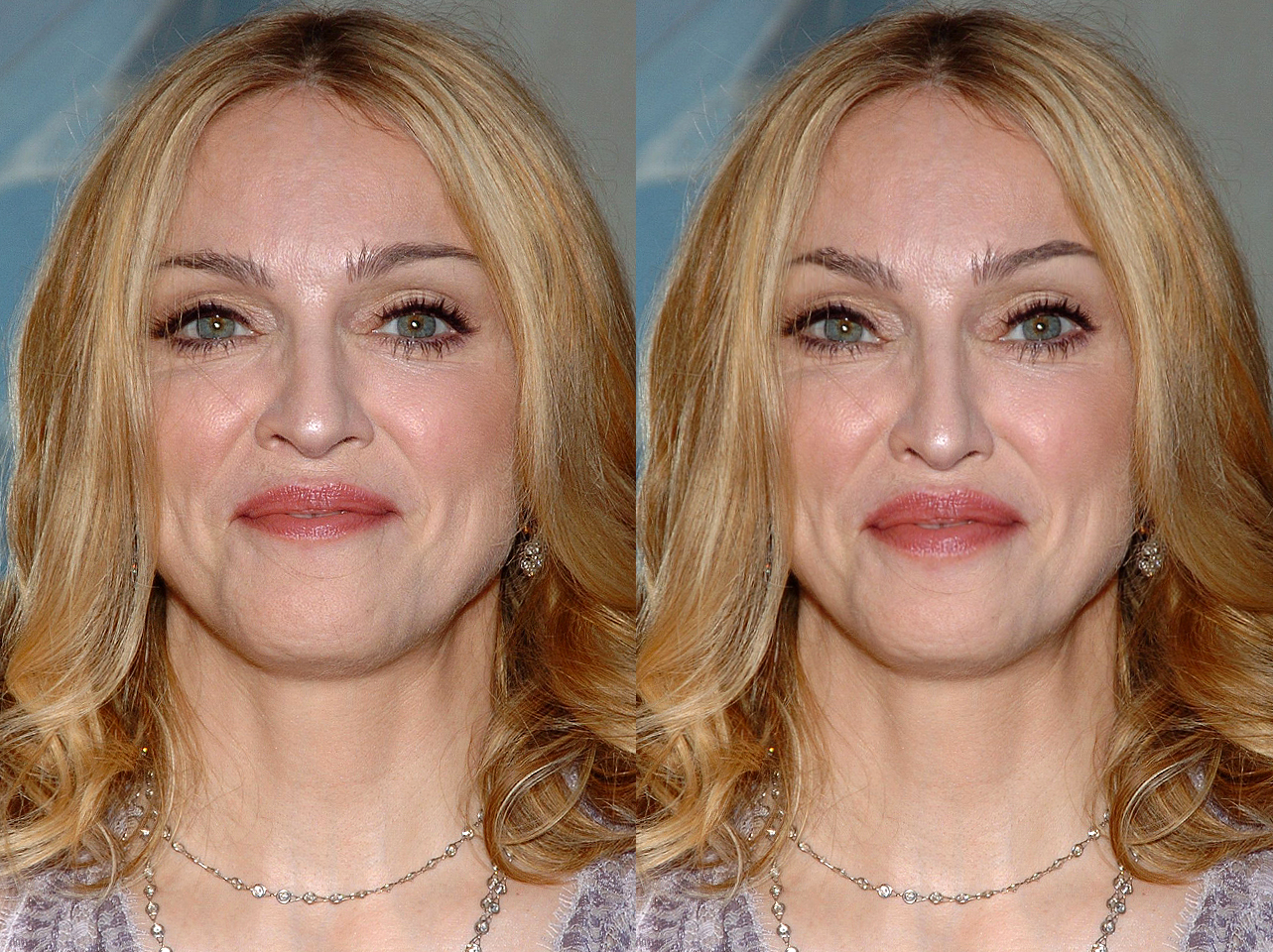 Madonna vs ce à quoi elle ressemblerait avec le Golden Ratio | Source : Getty Images