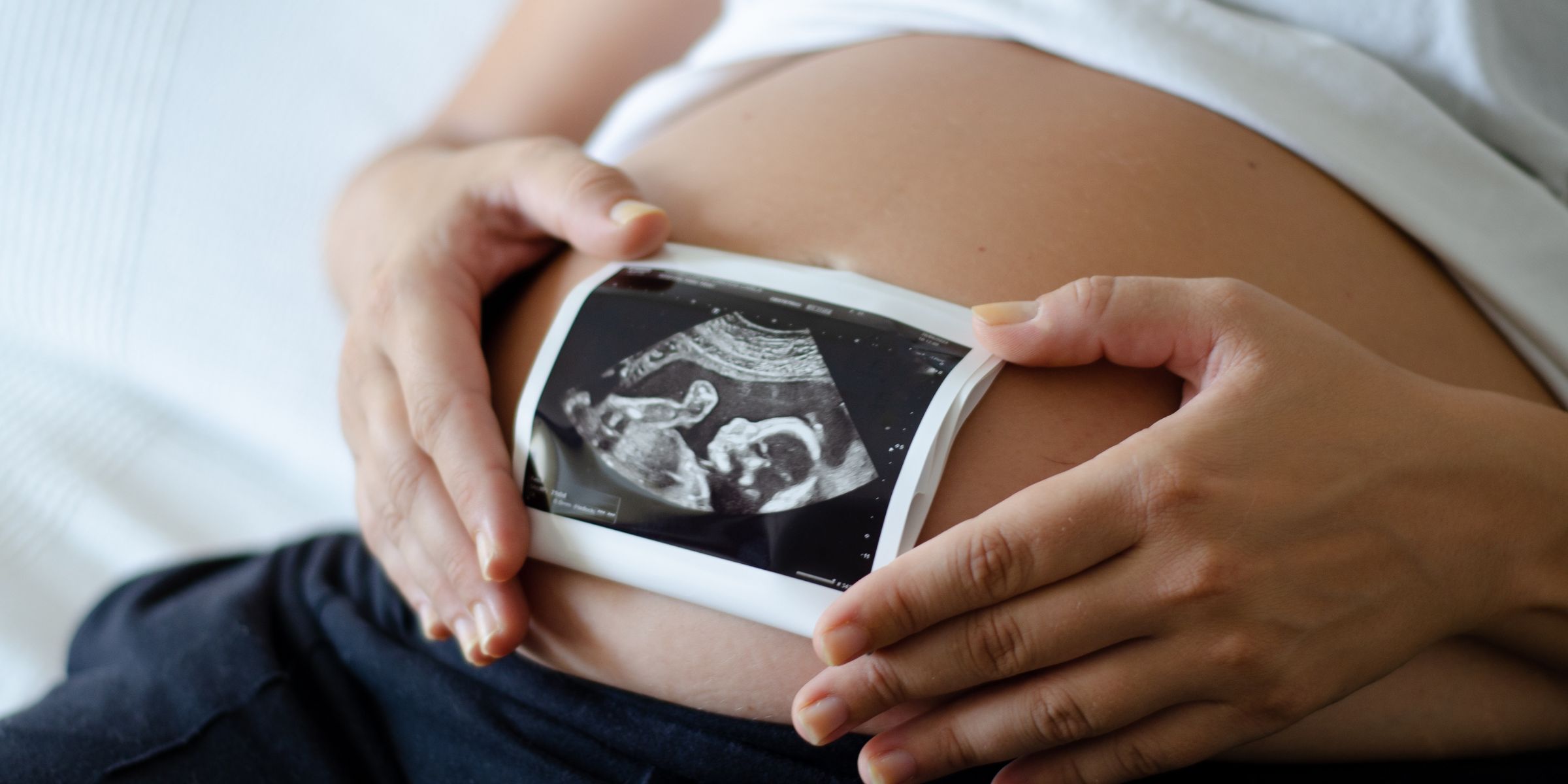 Een zwangere vrouw houdt een echografiebeeld boven haar buik | Bron: Shutterstock
