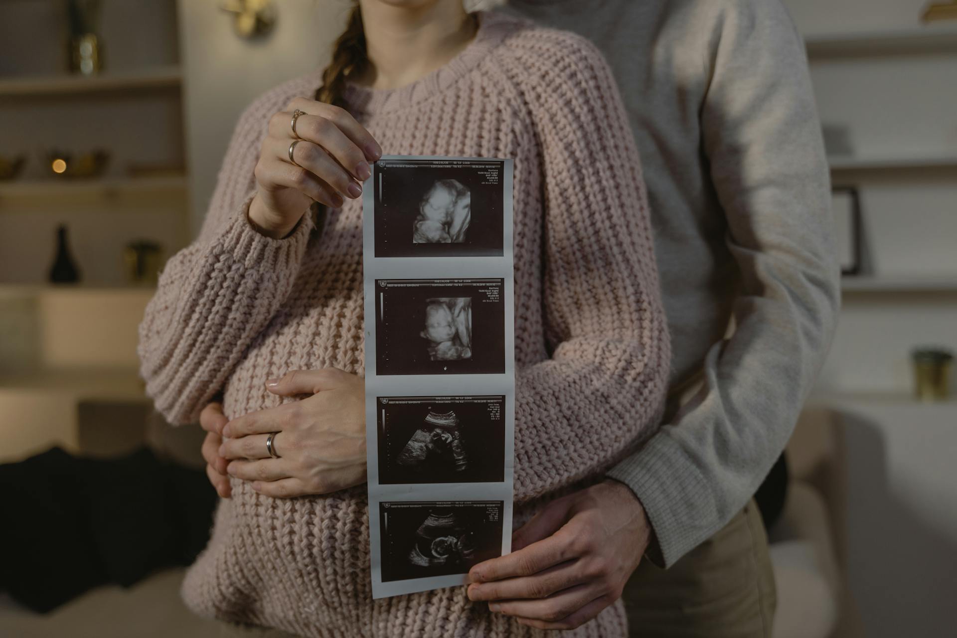 Un couple de femmes enceintes tenant une photo d'échographie | Source : Pexels