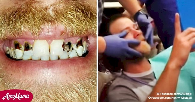 Le dentiste redonne le sourire à cet homme gêné après tant d'années de malaise