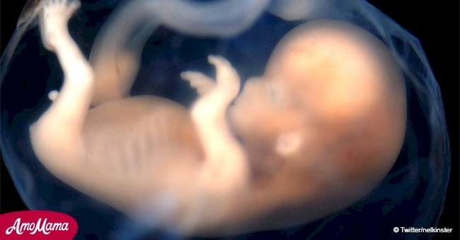 Les médecins gèlent pendant 7 minutes lorsque le dernier triplet est né dans son cocon