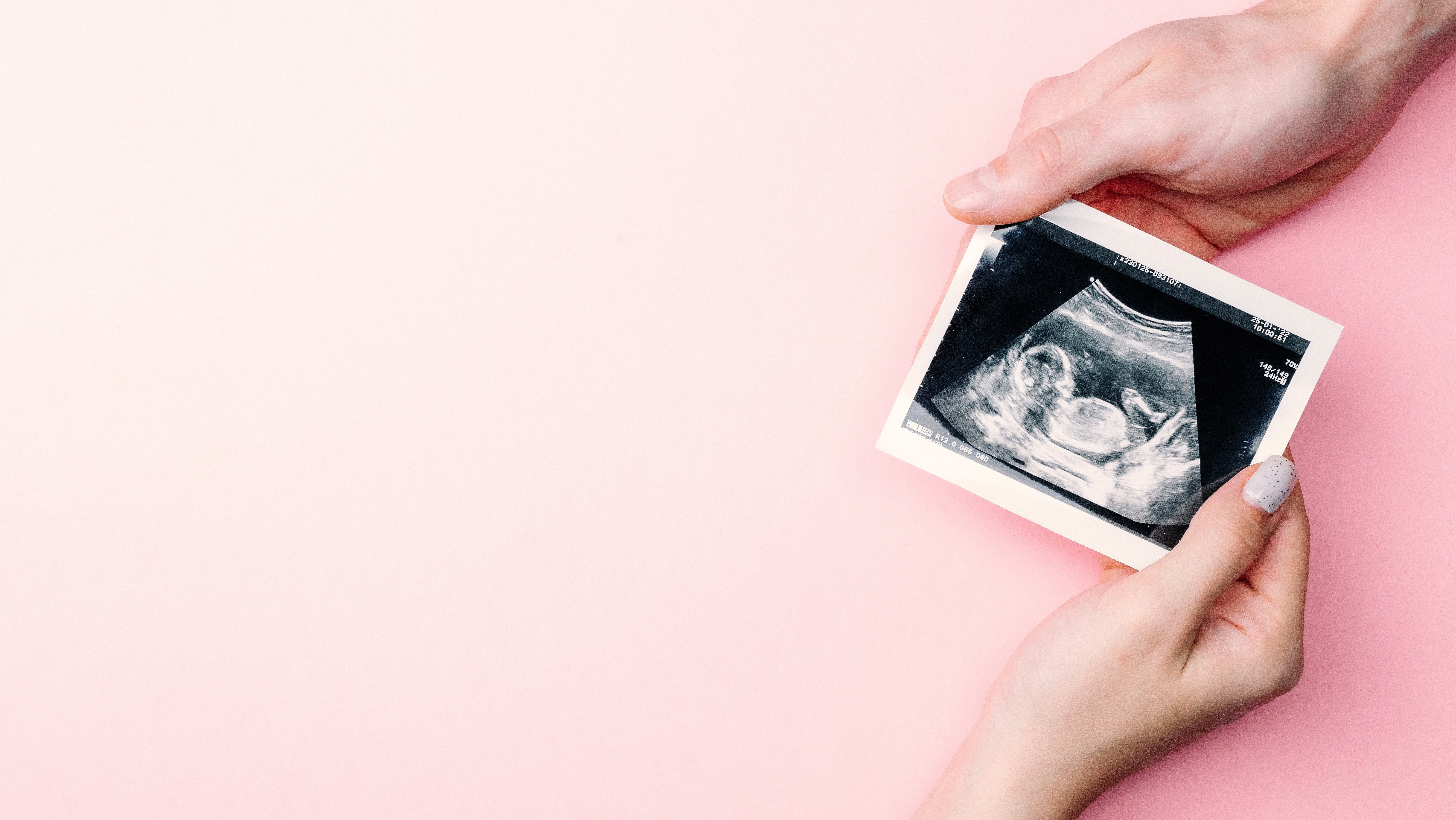 Imagen de ecografía foto de bebé embarazada | Fuente: Shutterstock