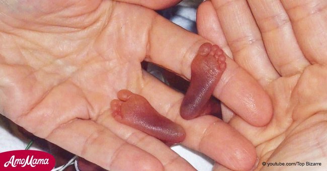 Une petite fille qui est née à seulement six mois de gestation accrochée à la vie et qui a miraculeusement survécu