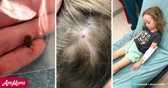 Une fillette de 5 ans a été retrouvée muette et paralysée pendant 12 heures: un insecte habituel l'a mordue