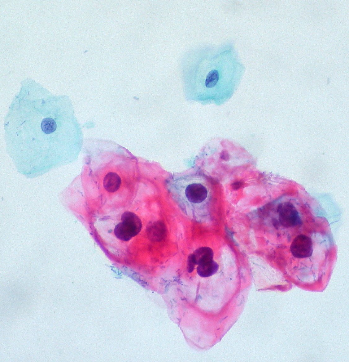 Le papillomavirus humain (VPH). l Source: Wikimedia Commons