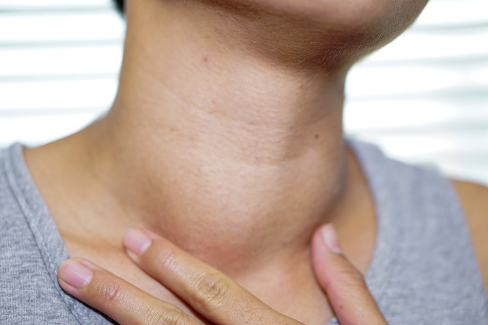 Une femme avec une grosseur suspecte dans le cou | Source : Shutterstock