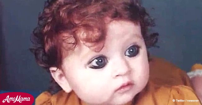 Cette petite fille indienne était rousse et était considérée comme un monstre, mais 20 ans plus tard elle est méconnaissable