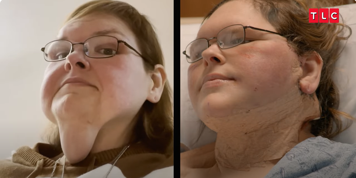 Une photo montrant Tammy Slaton avant et après son opération, tirée d'un post vidéo daté du 6 juin 2025 | Source : YouTube/TLC