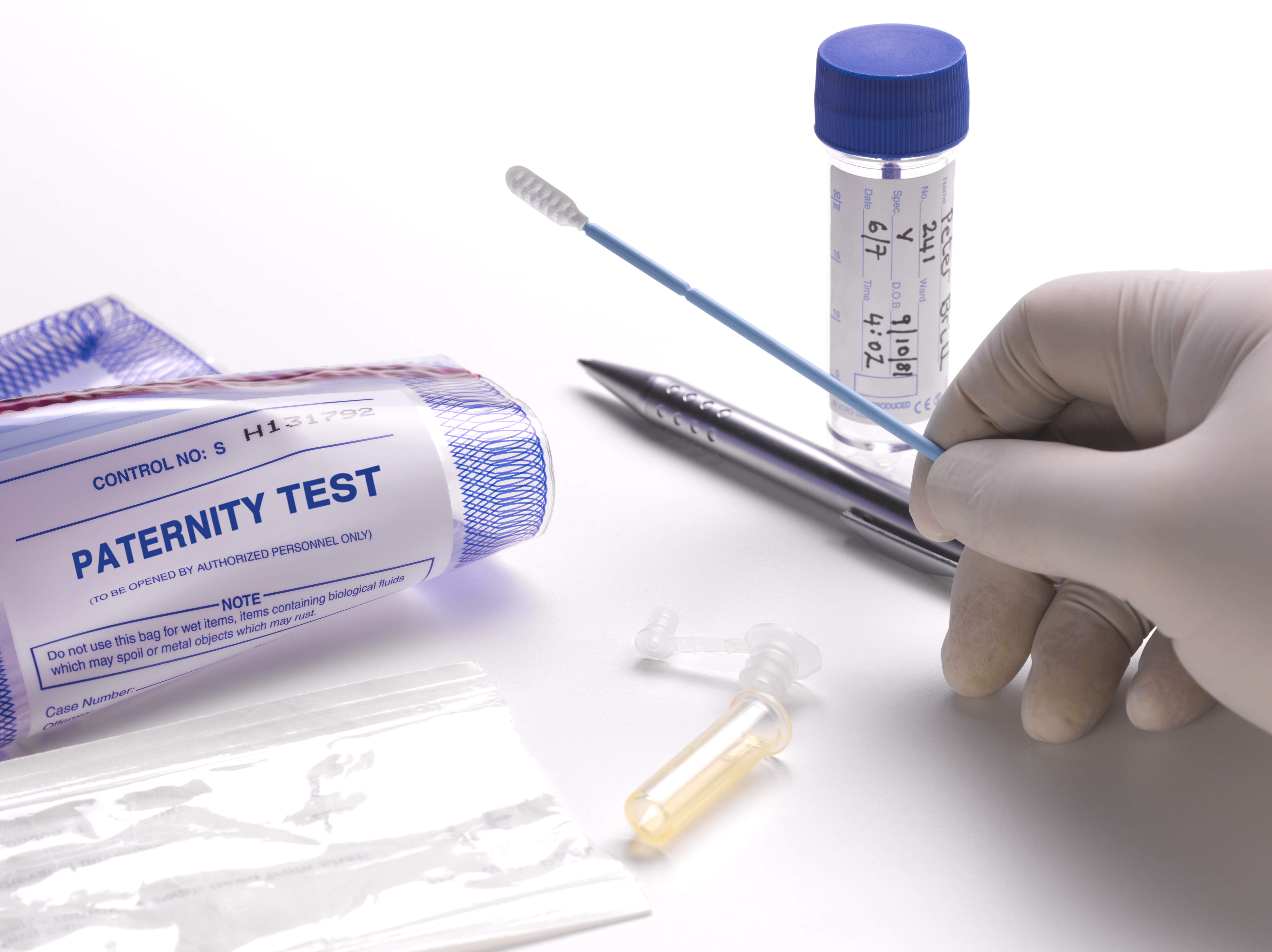 Prélèvement d'ADN pour un test de paternité | Source : Getty Images