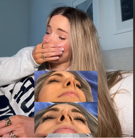 Un aperçu de la narine affaissée d'Isabelle Lux, vue dans un post daté du 14 avril 2025 | Source : TikTok/@isabelle.lux