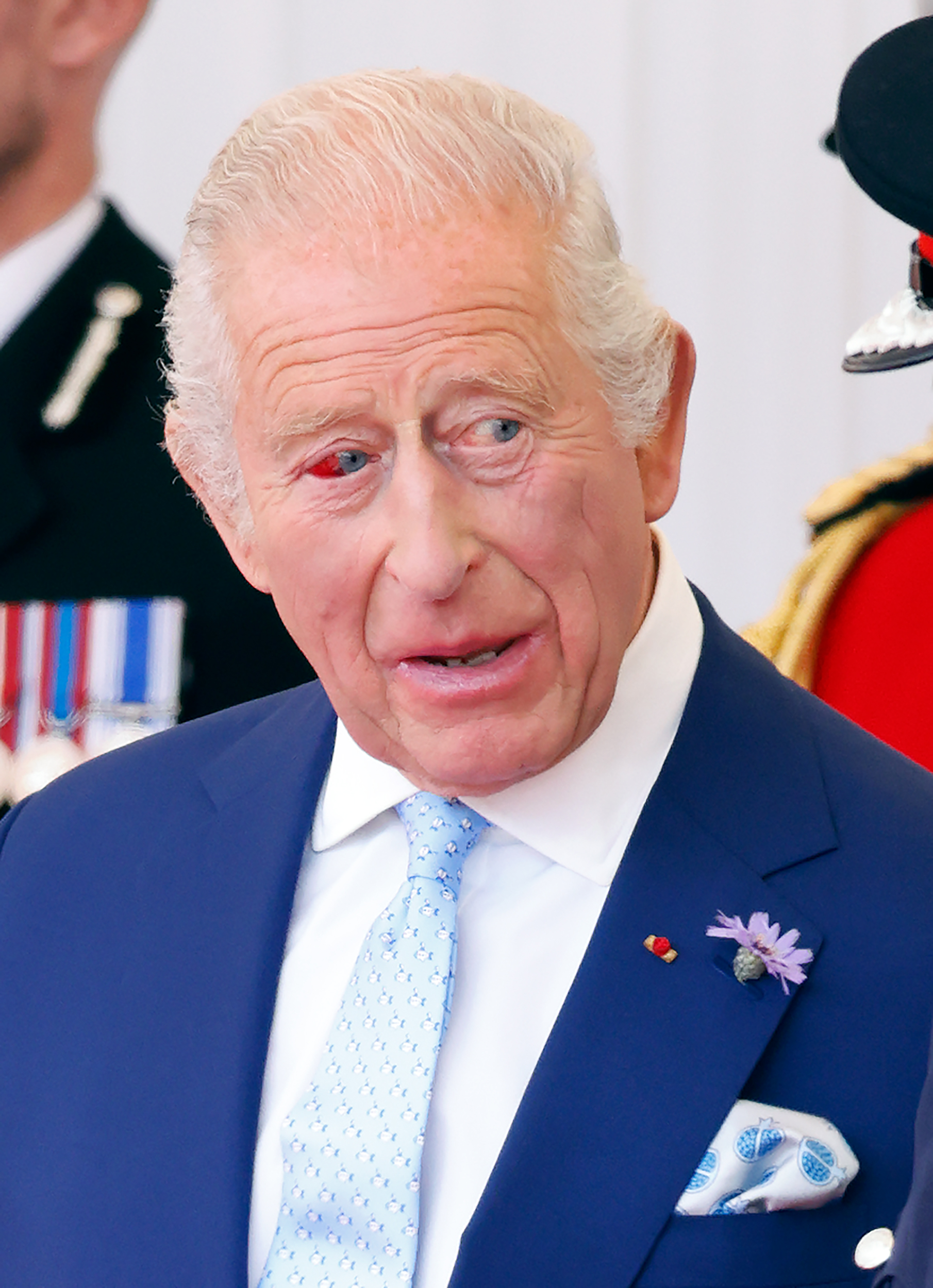 L'œil injecté de sang du roi Charles III ressort clairement sur ce gros plan alors qu'il s'entretient avec des personnes lors de l'arrivée du président français au Royaume-Uni. Ce moment, qui s'inscrit dans la tradition de Windsor, mêle devoir royal et vulnérabilité apparente.