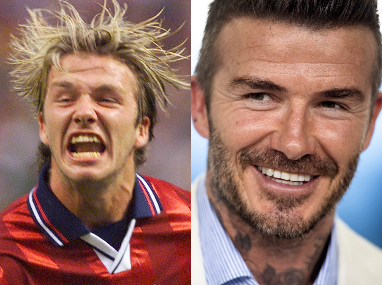 Avant et après du sourire de David Beckham. | Source : Getty Images