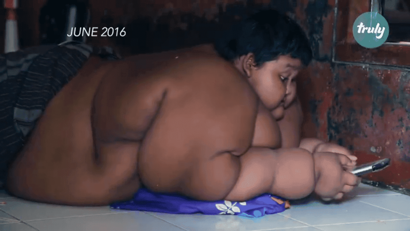 L'enfant le plus lourd du monde perd environ 100 kilos | Source : Barcroft TV/Youtube