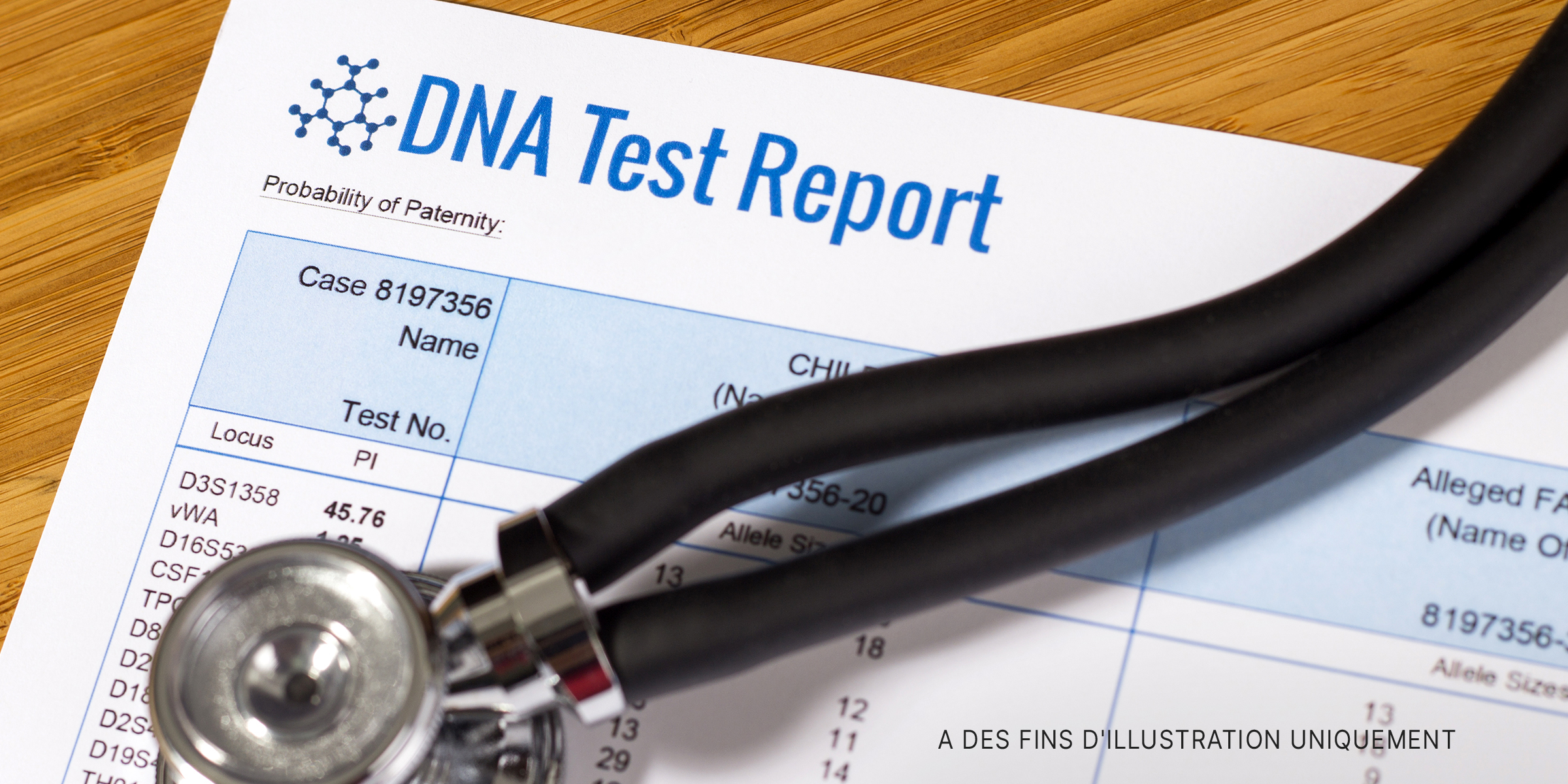 Un test ADN surmonté d'un stéthoscope | Source : Shutterstock