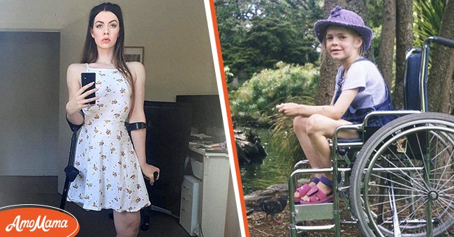 Une fille a perdu sa jambe à cause d'un cancer à l'âge de six ans et, des années plus tard, elle est devenue un mannequin à succès | Photo : Instagram/cherie.louise