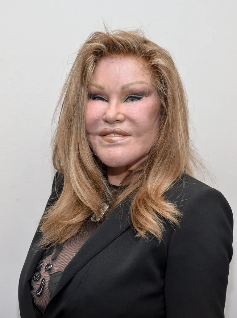 Jocelyn Wildenstein assiste à l'exposition Jean-Yves Klein : Chimeras Exhibition à la galerie Molly Krom à New York, le 8 octobre 2015. | Source : Getty Images