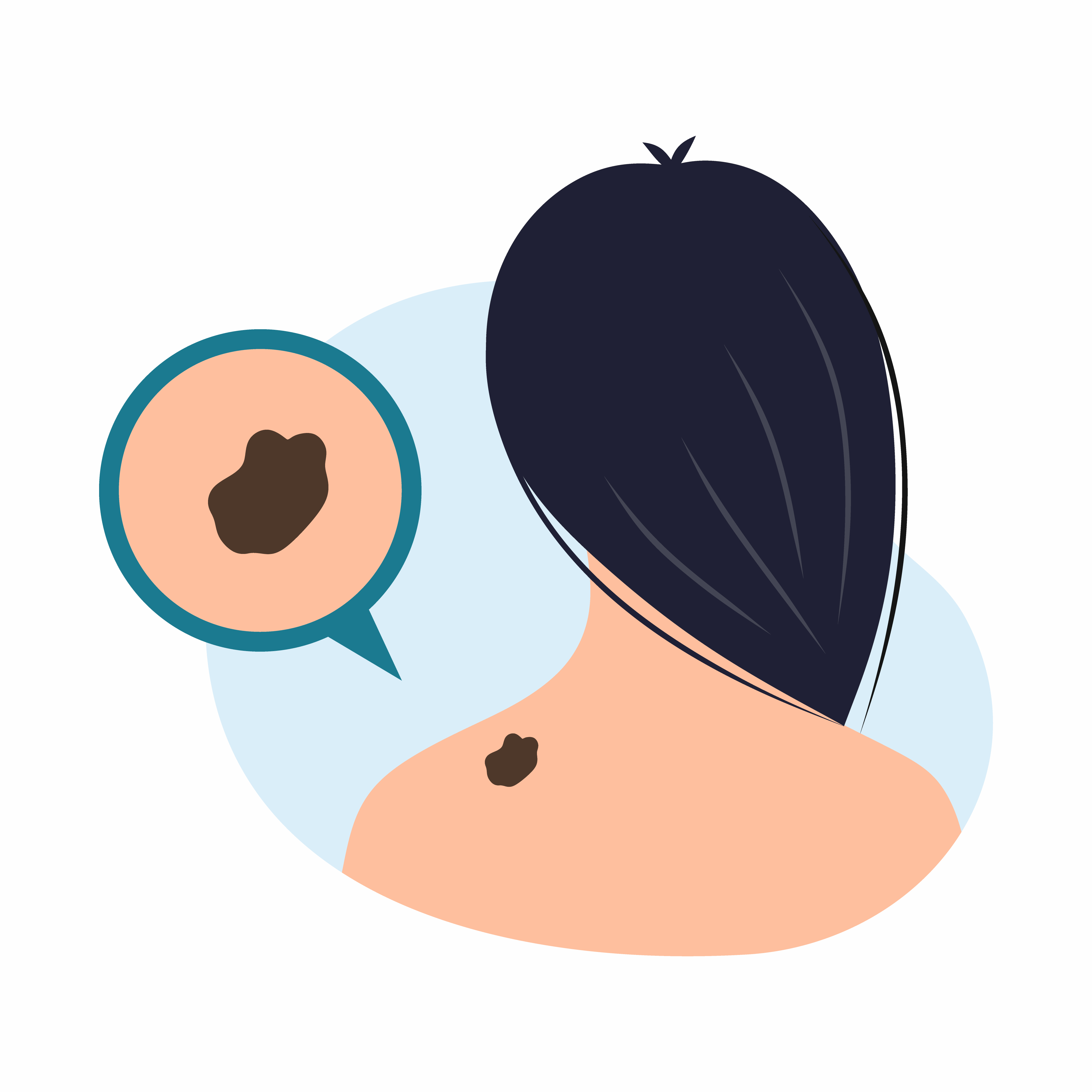 Jeune femme avec une tache de naissance sur le cou, soulignant les préoccupations soulevées lors de la Journée mondiale du mélanome sur l'importance de surveiller les changements de la peau pour y déceler des signes de cancer | Source : Getty Images