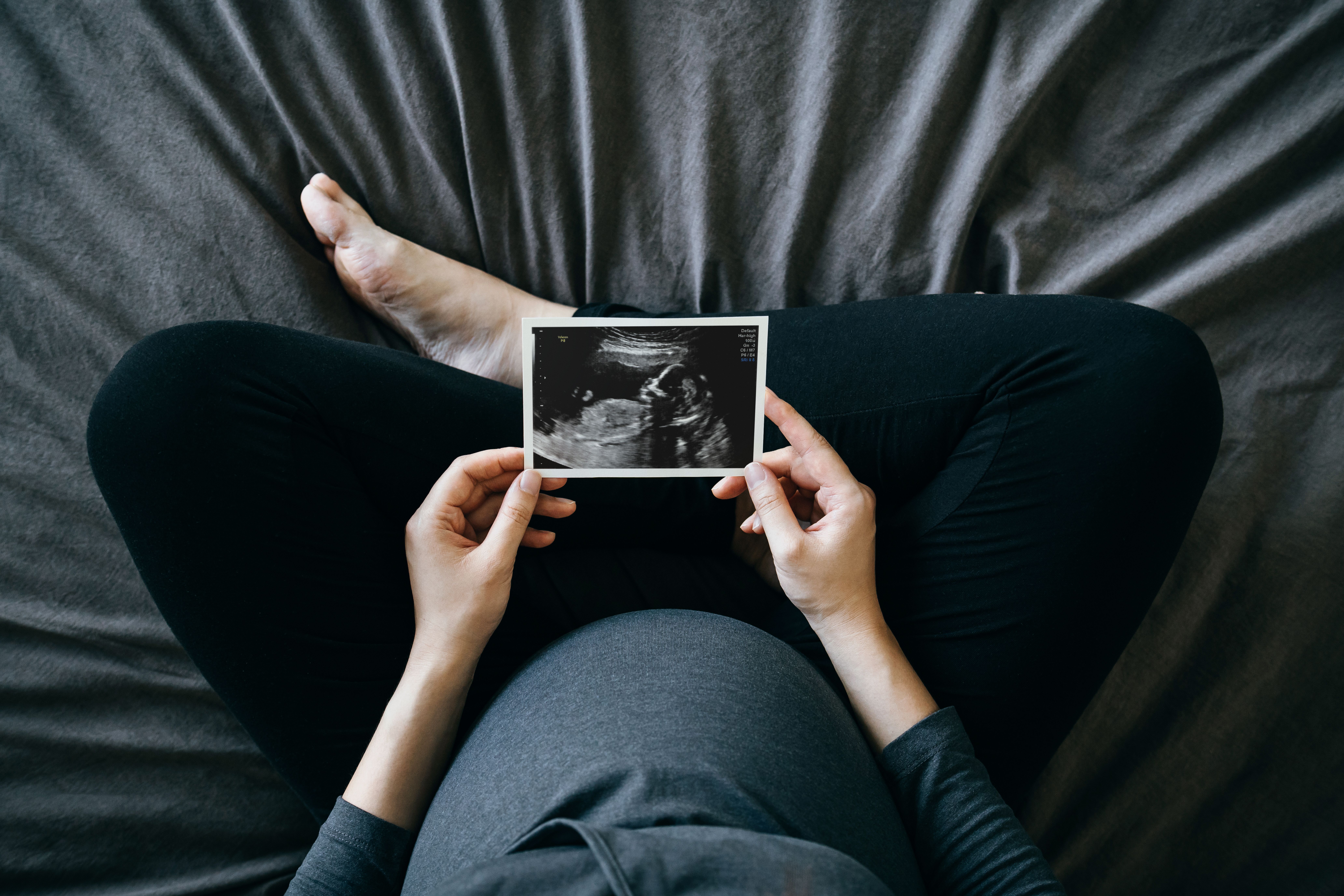 Une femme enceinte tenant une échographie de son bébé. | Source : Getty Images