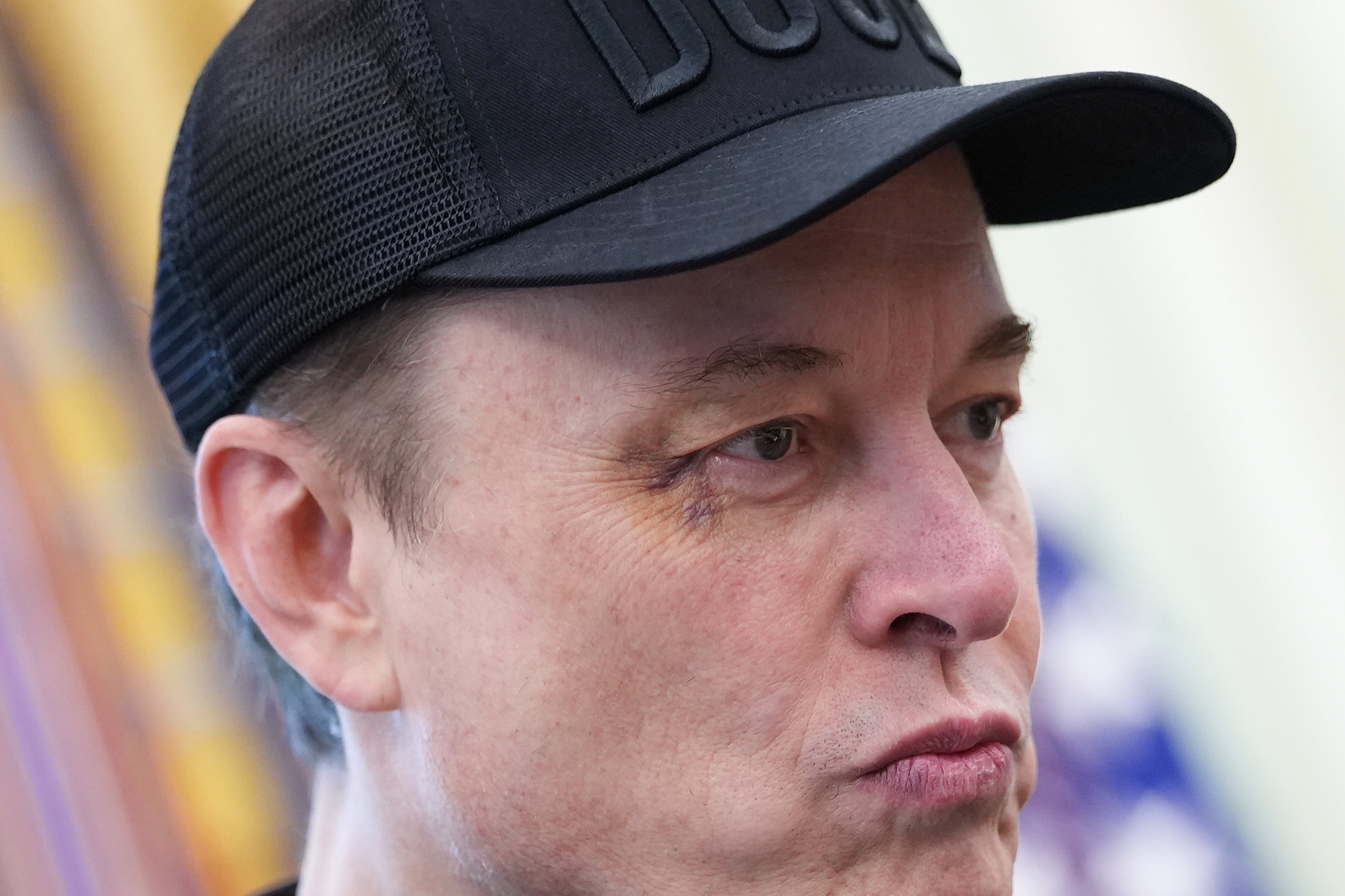 Que ce soit à cause du temps de jeu ou d'autre chose, la dernière apparition de Musk dans l'administration Trump a laissé une marque — au sens propre du terme.