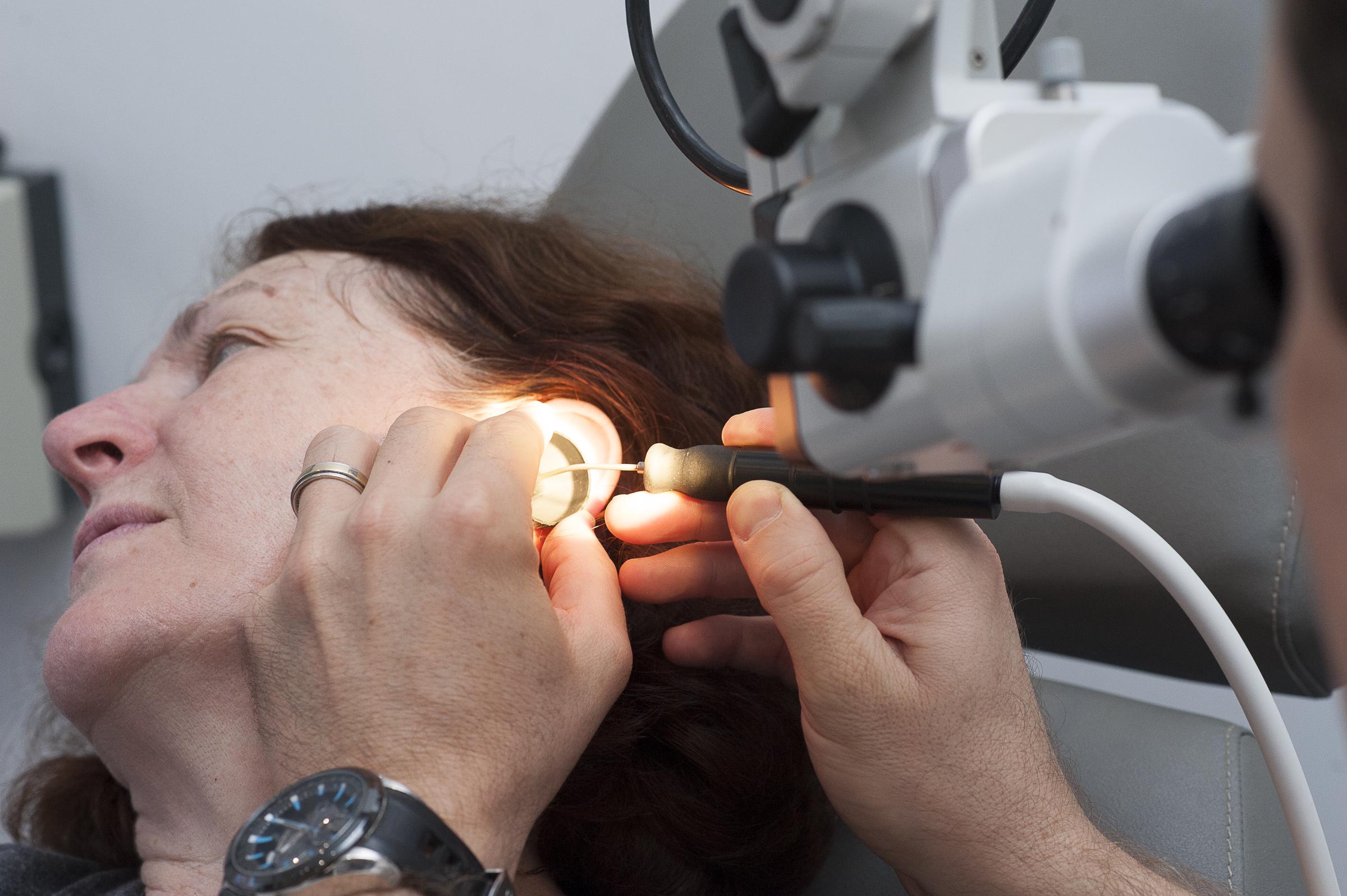 Examen détaillé de l'oreille effectué par un médecin ORL à l'aide d'outils de précision et d'un microscope chirurgical | Source : Getty Images