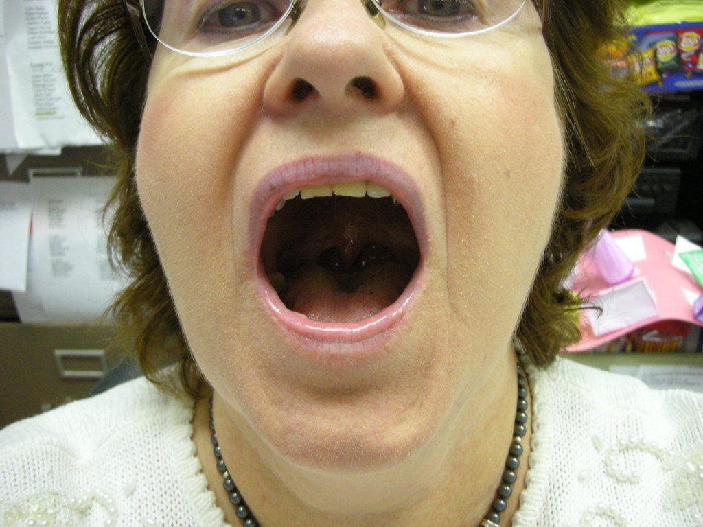 Femme à la bouche ouverte. | Photo : Flickr