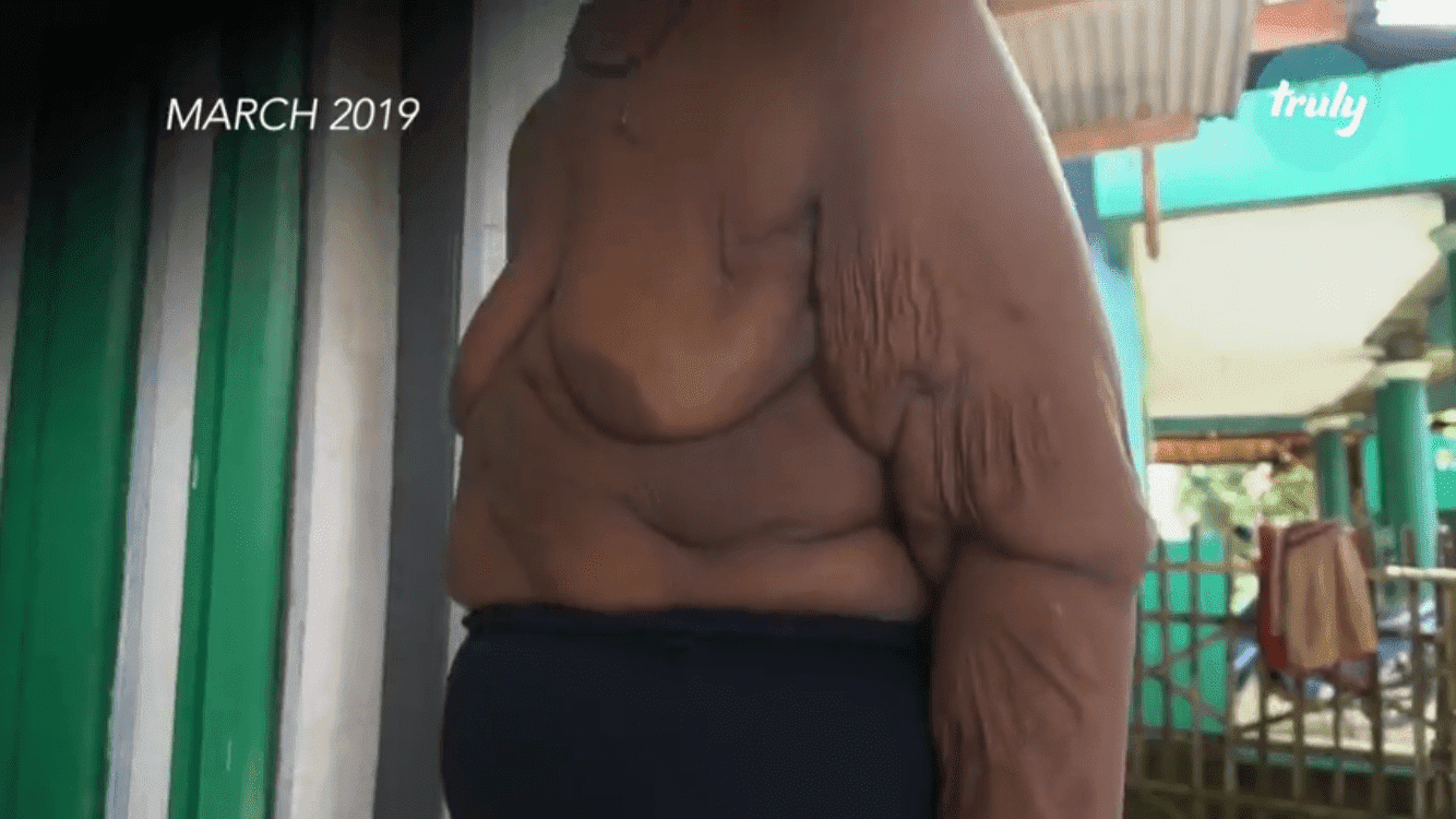 L'enfant le plus lourd du monde après sa transformation | Source : Barcroft TV/Youtube