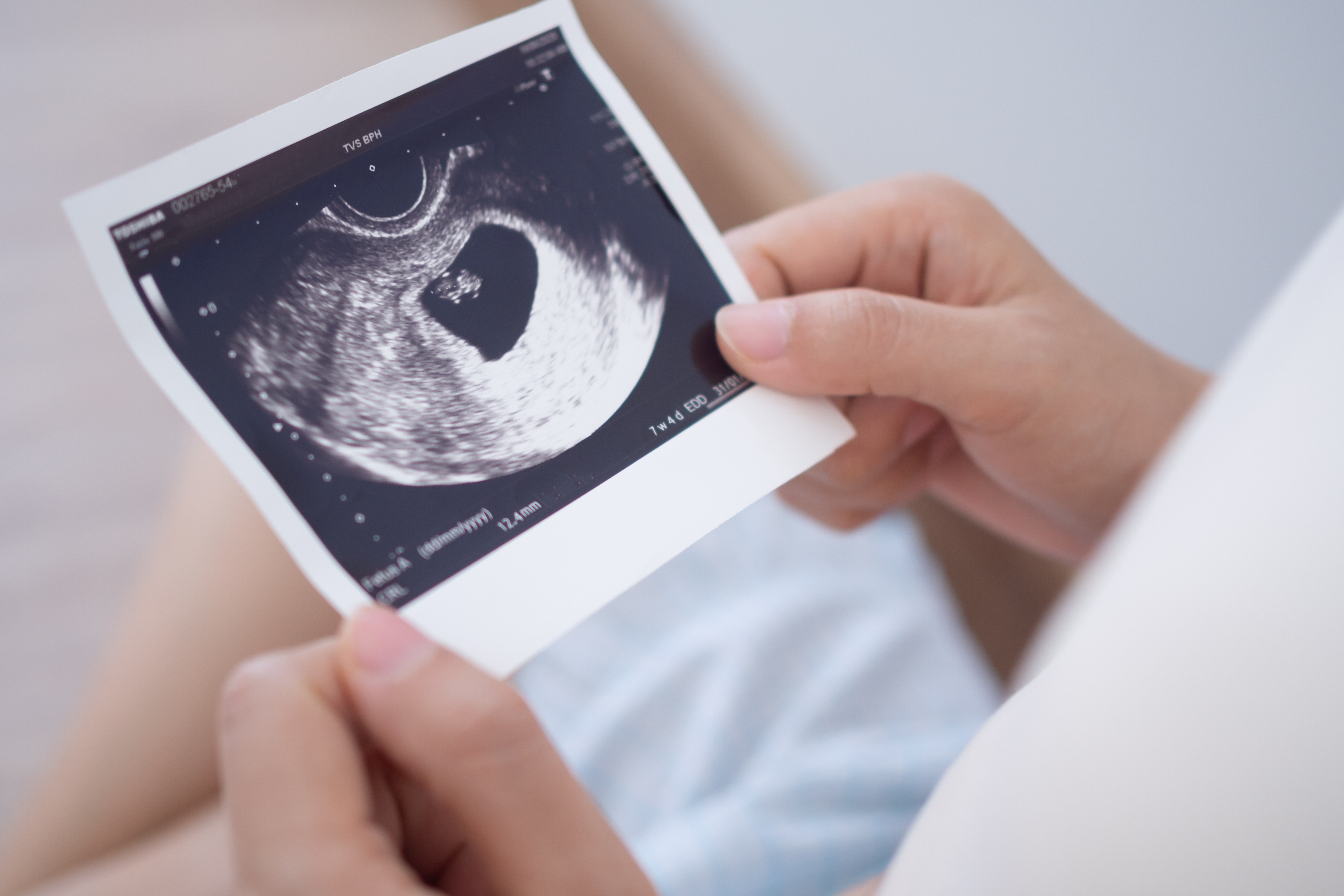 Femme enceinte regardant une photo d'échographie du fœtus | Source : Shutterstock