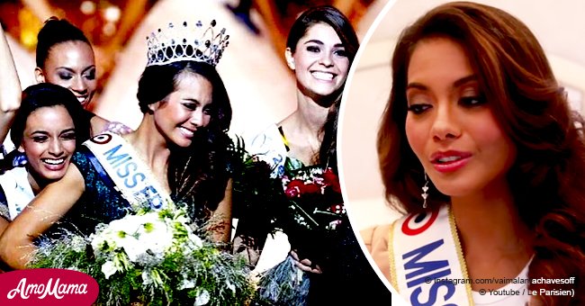 Miss France Vaimalama Chaves confrontée à des problèmes de santé en raison d'une "perte de poids trop rapide"