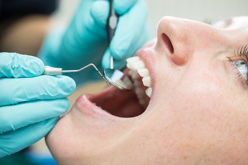 Dentiste tenant un miroir incliné et un crochet pendant l'examen du patient. | Photo : Getty Images