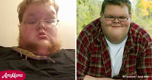 Un garçon de 15 ans pesait 320kg, mais il était méconnaissable après la chirurgie