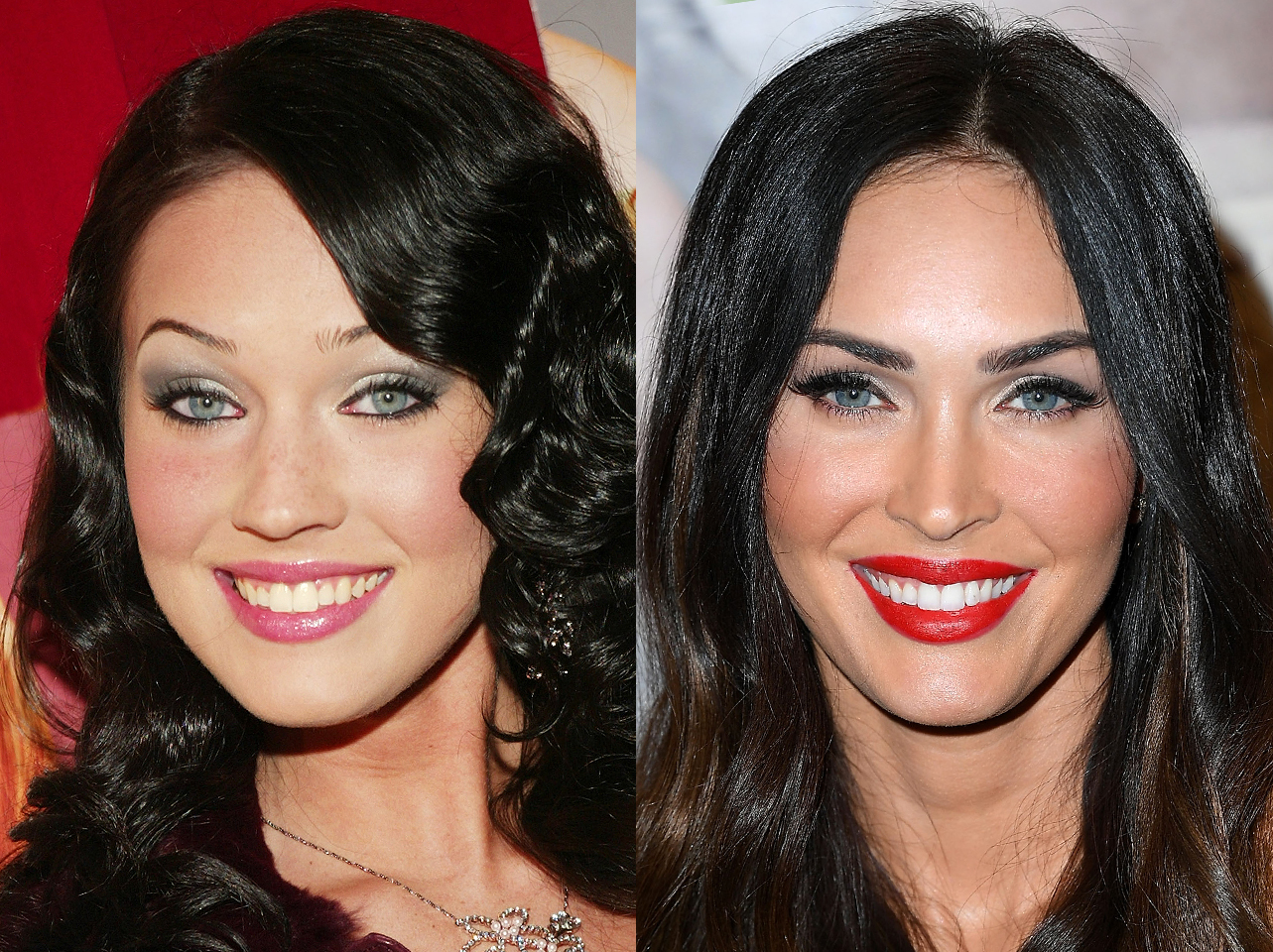 Avant et après du sourire de Megan Fox. | Source : Getty Images