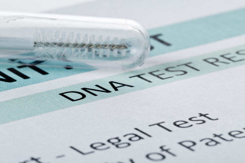 Resultado do teste de DNA | Shutterstock