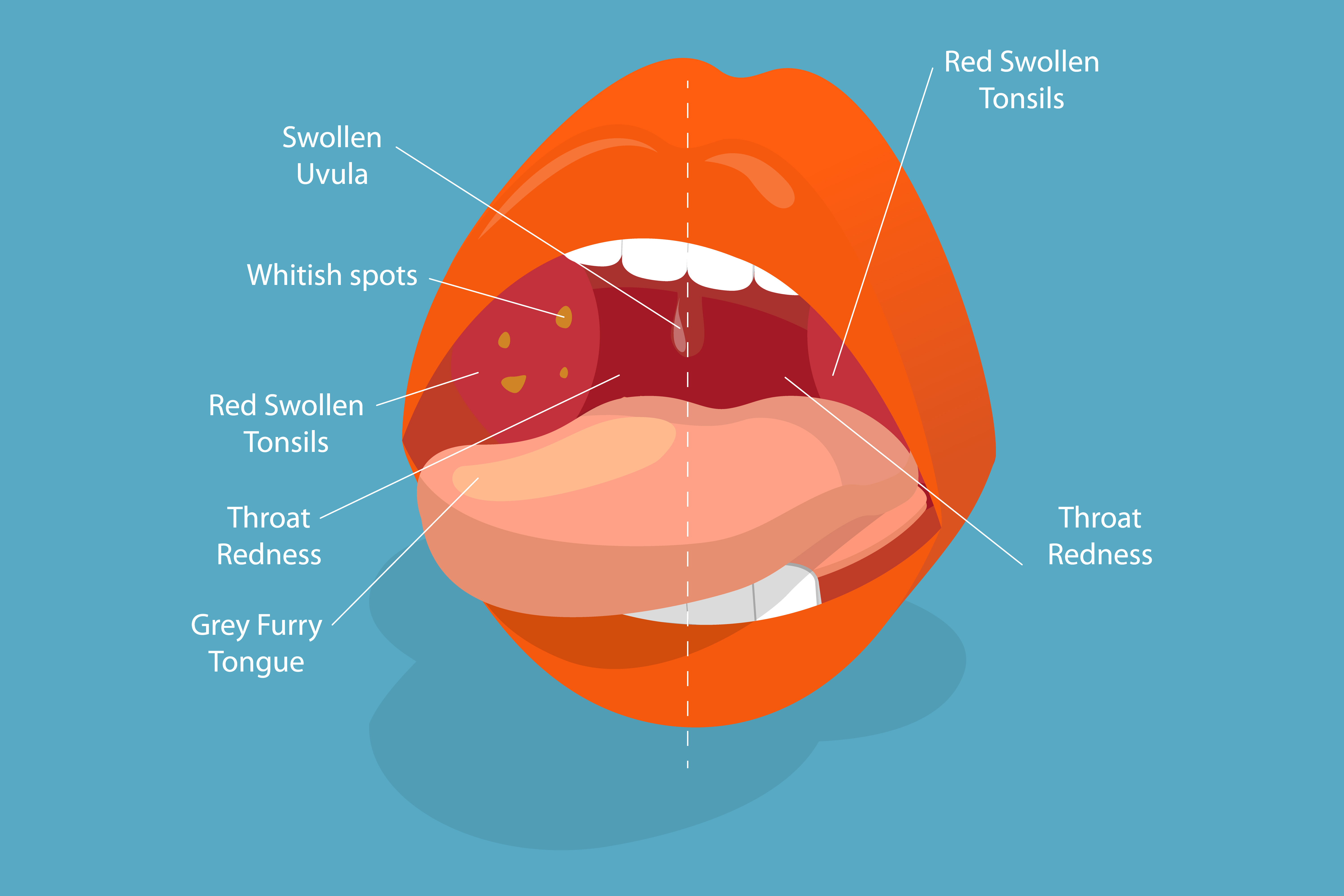 Illustration conceptuelle vectorielle plate isométrique en 3D des parties de la bouche humaine | Source : Getty images