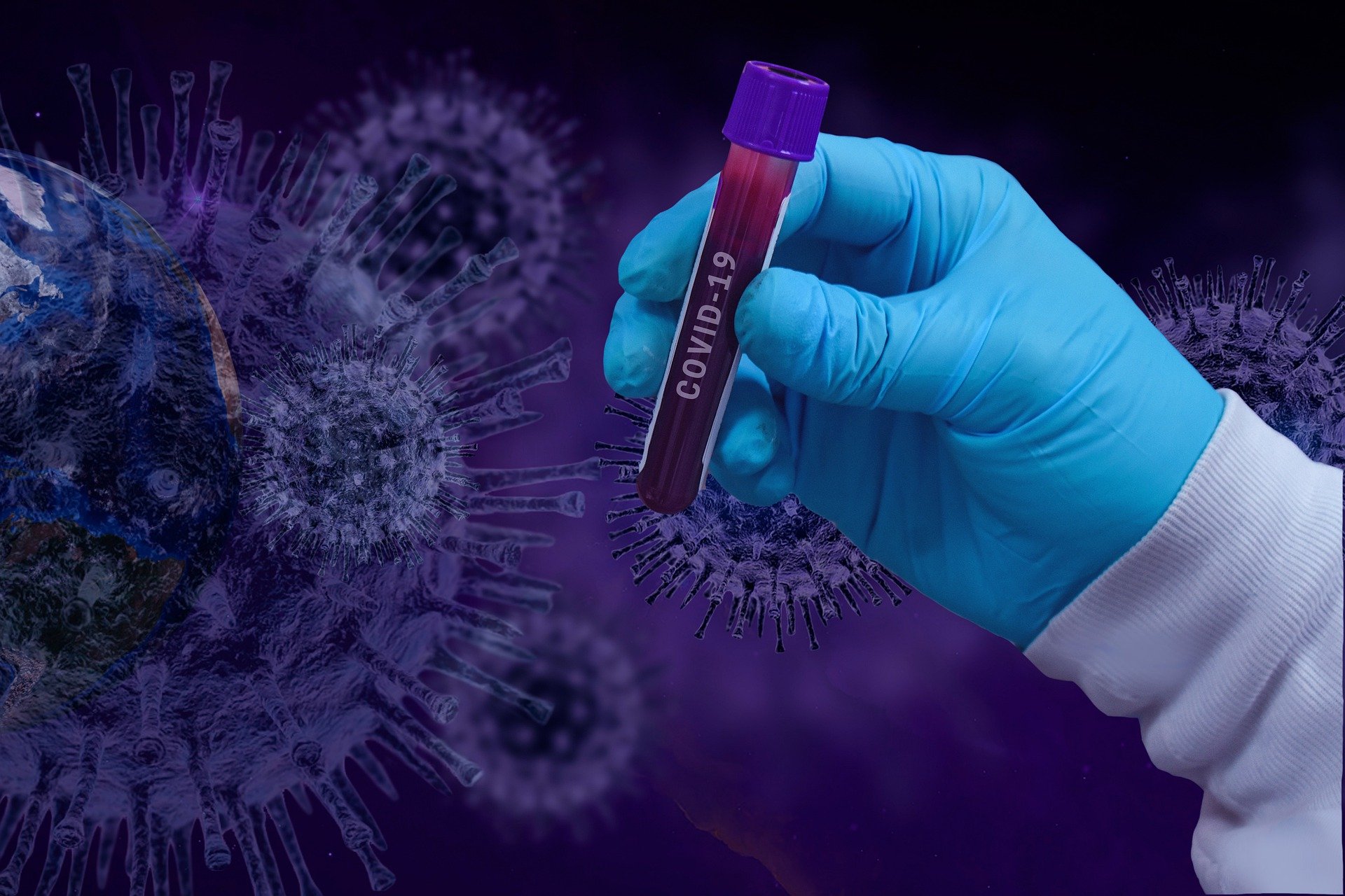 Illustration du sang prélevé pour tester le coronavirus COVID-19. | Source : Getty Images